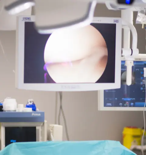 Artroscopia De Ombro